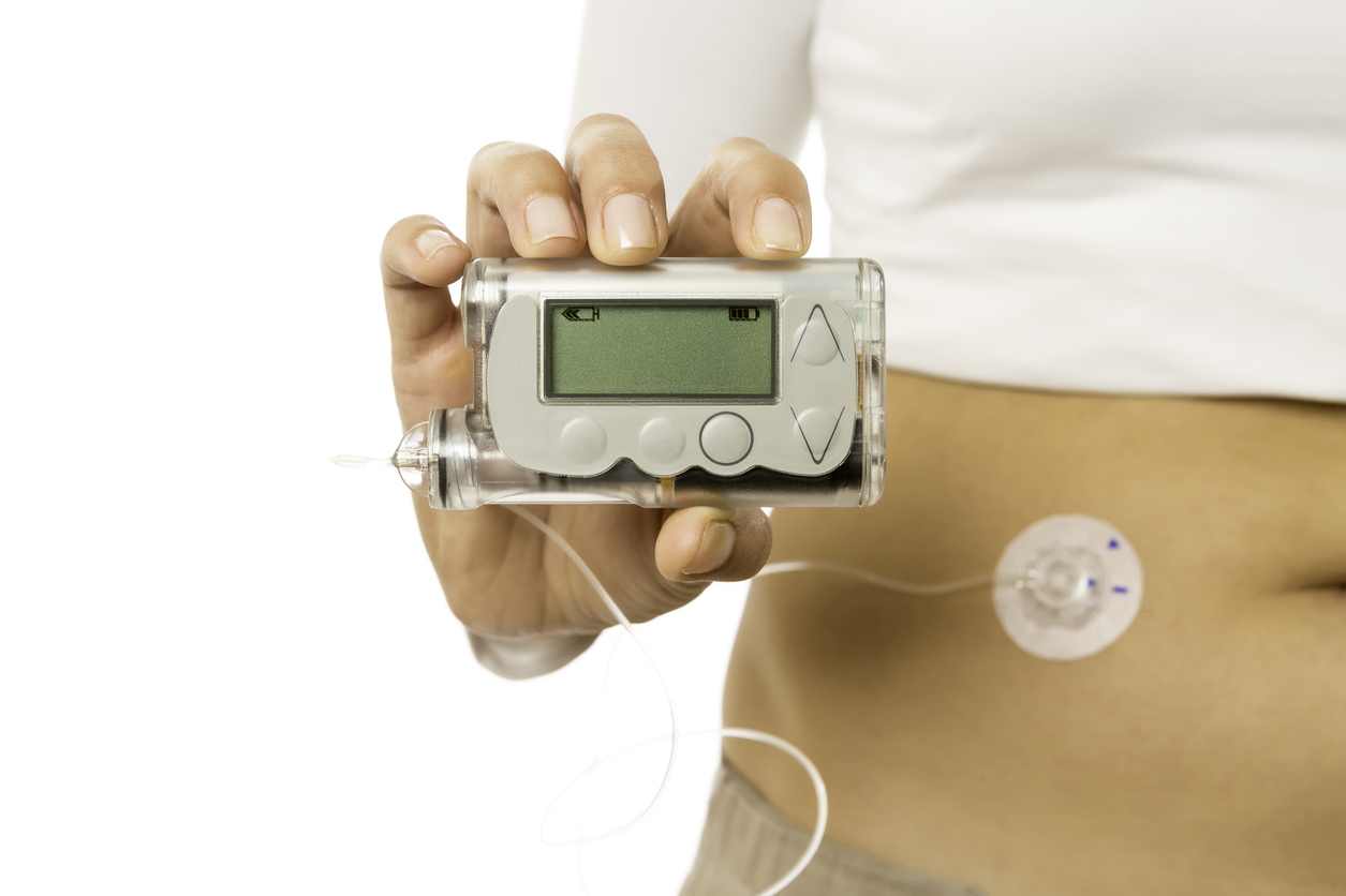 Image for Patient experience - using an insulin pump