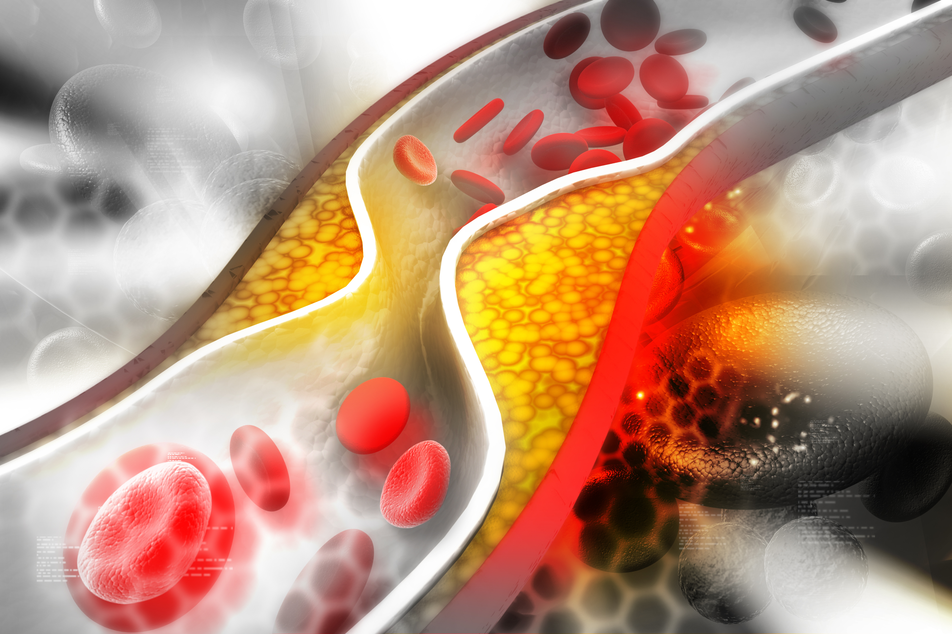Image for Cholesterol, reducing your risk of complications
